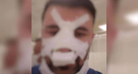 Reklam ve Mesajlarınızla Daha Özgür